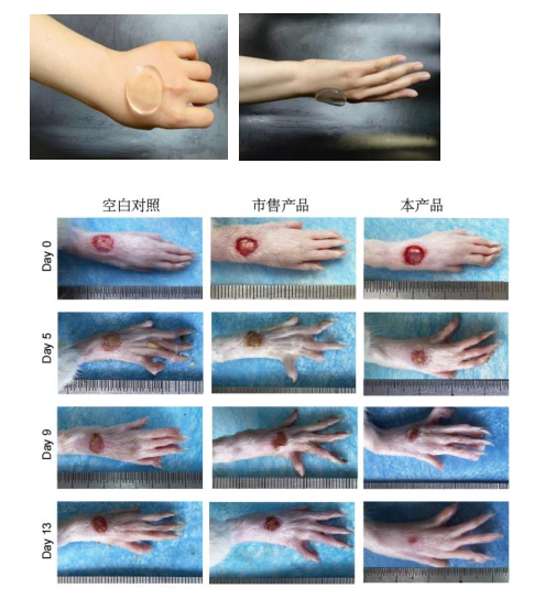 可实现糖尿病伤口诊疗一体化的葡萄糖/ROS/MMP-9 响应水凝胶构建 及作用机制研究